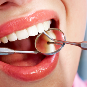 E-cigaretta, kávé, energiaital - mit “szólnak” a fogaink?